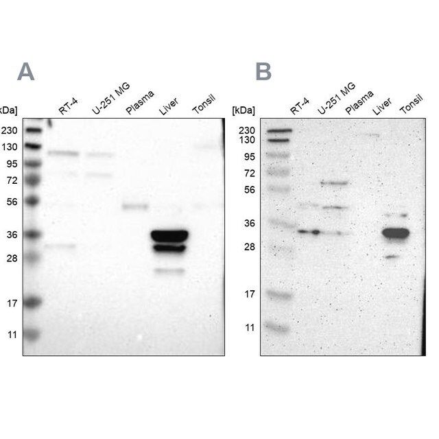 Anti-PHYH antibody produced in rabbit