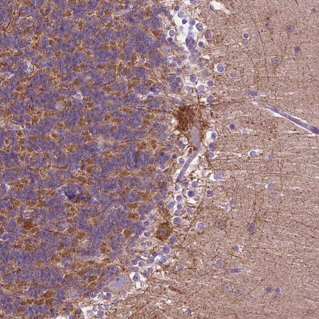 Anti-PHYHIP antibody produced in rabbit