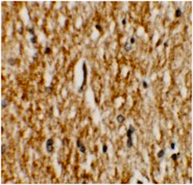 Anti-PHOX2A Antibody