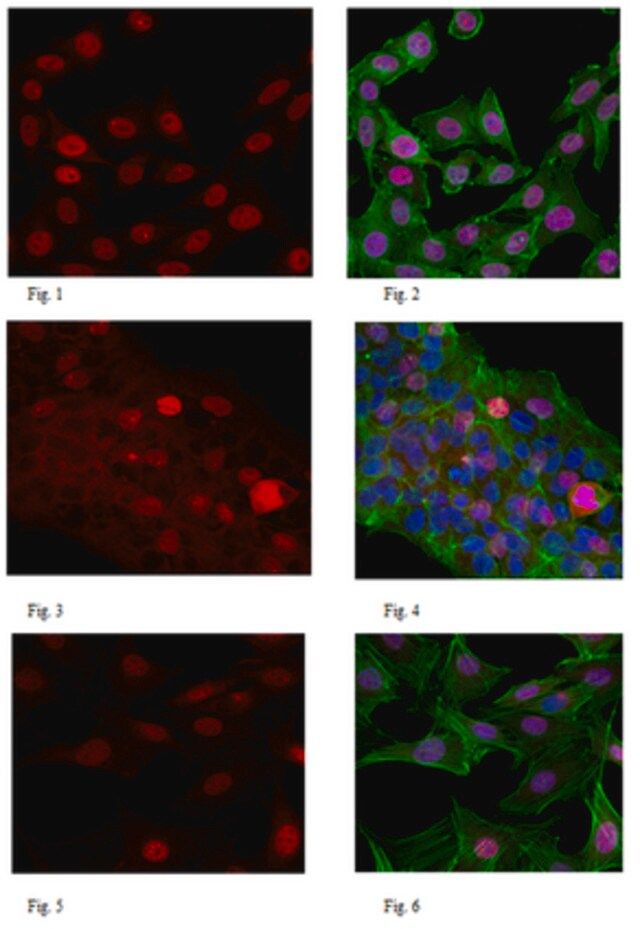 Anti-PIDD Antibody, clone 1511.1