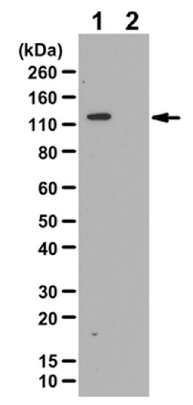 Anti-phospho-ULK1/ATG1 (Ser758) Antibody