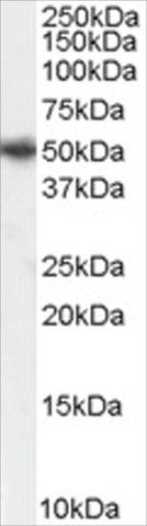 Anti-PICK1 antibody produced in goat