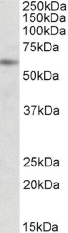 Anti-PIAS2 antibody produced in goat