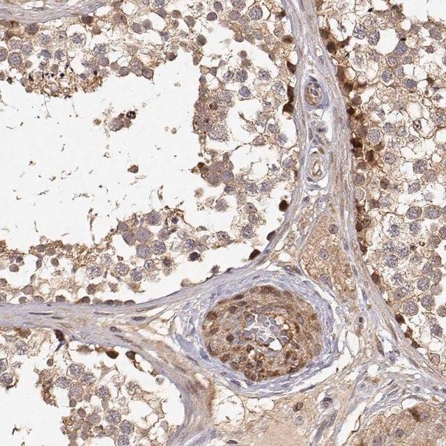 Anti-PICK1 antibody produced in rabbit