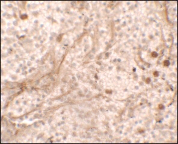 Anti-PIBF1 antibody produced in rabbit