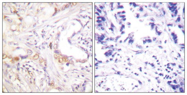 Anti-PIAS3 antibody produced in rabbit