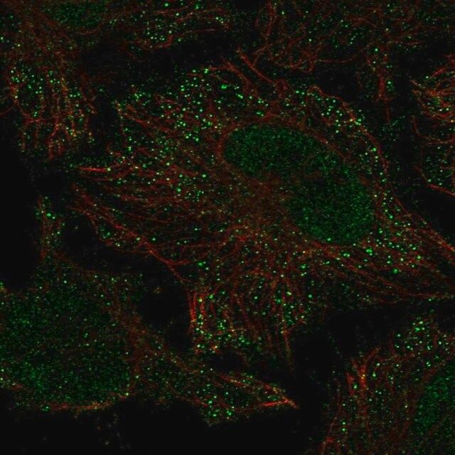 Anti-PIEZO2 antibody produced in rabbit