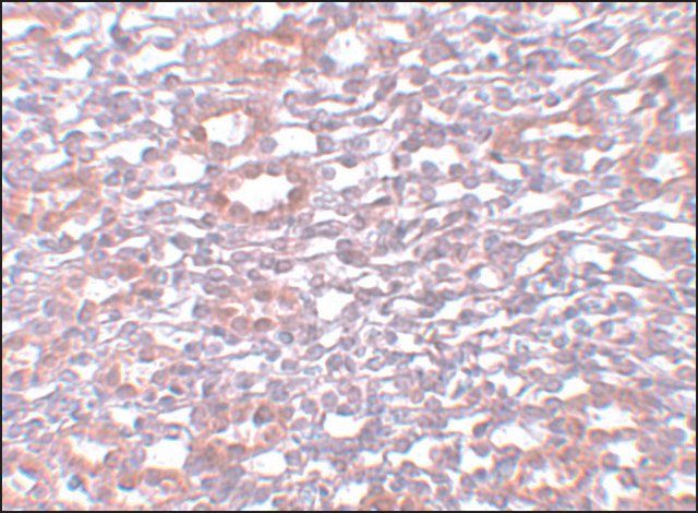 Anti-PIAS1 antibody produced in rabbit