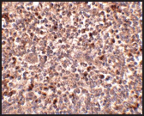 Anti-PIG-Y (ab1) antibody produced in rabbit