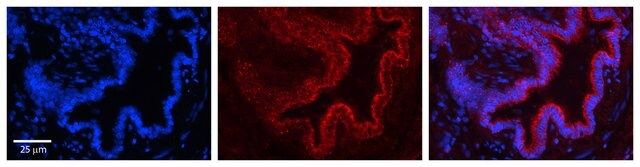 Anti-PIGF antibody produced in rabbit