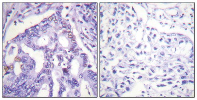 Anti-PIAS4 antibody produced in rabbit