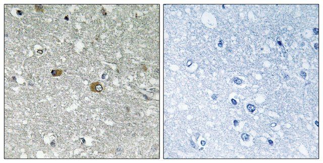 Anti-PIGH antibody produced in rabbit