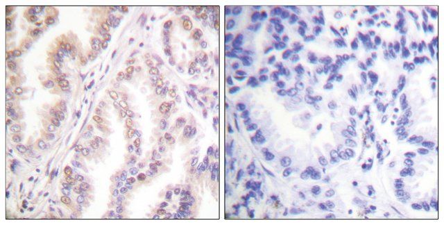 Anti-PIAS1 antibody produced in rabbit