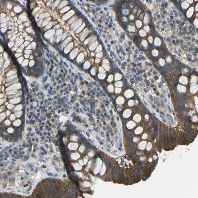 Anti-PIEZO2 antibody produced in rabbit