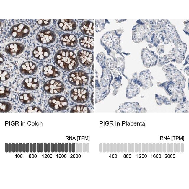 Anti-PIGR antibody produced in rabbit