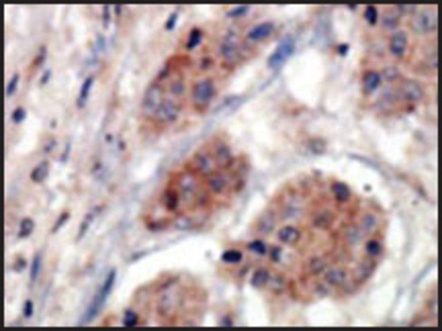 Anti-PI4K II (N-term) antibody produced in rabbit