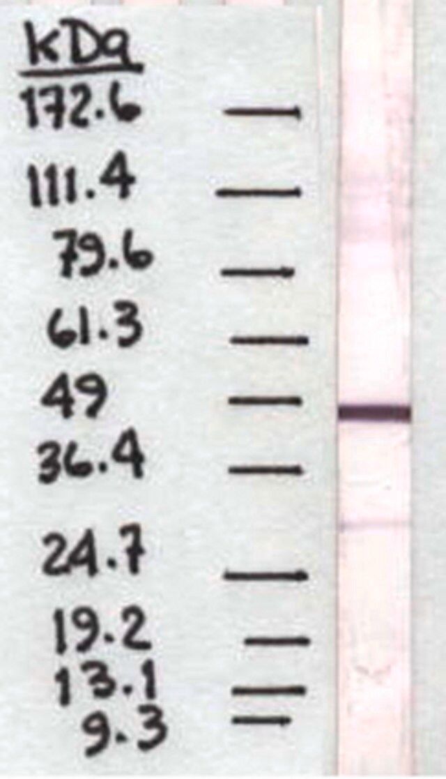 Anti-Pigment Epithelium Derived Factor Antibody, clone 10F12.2