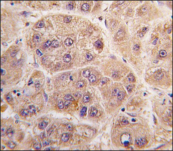 Anti-PIM3 (C-term) antibody produced in rabbit