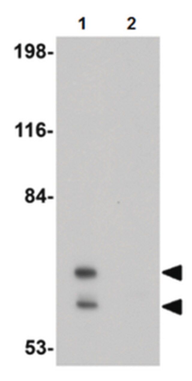 Anti-PICALM Antibody