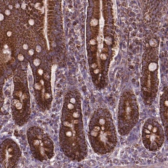 Anti-PIBF1 antibody produced in rabbit