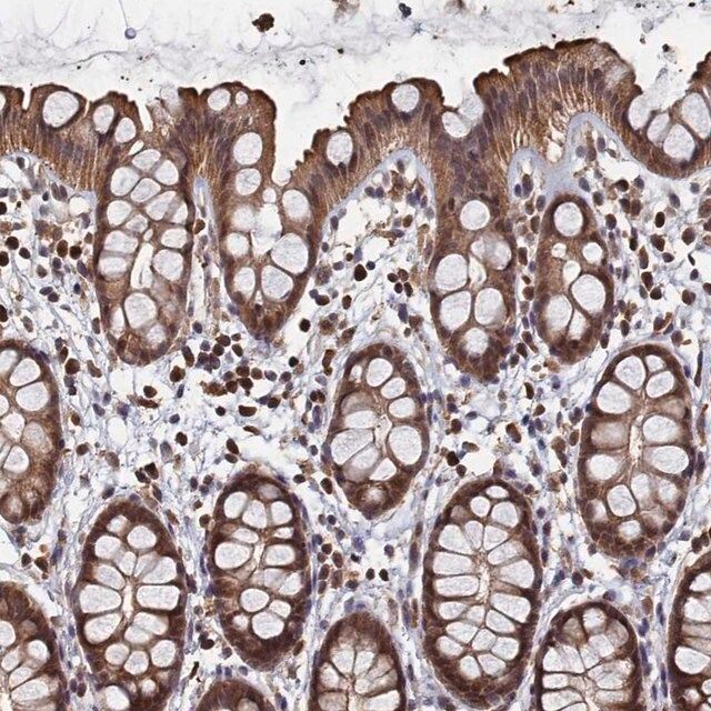 Anti-PIGN antibody produced in rabbit