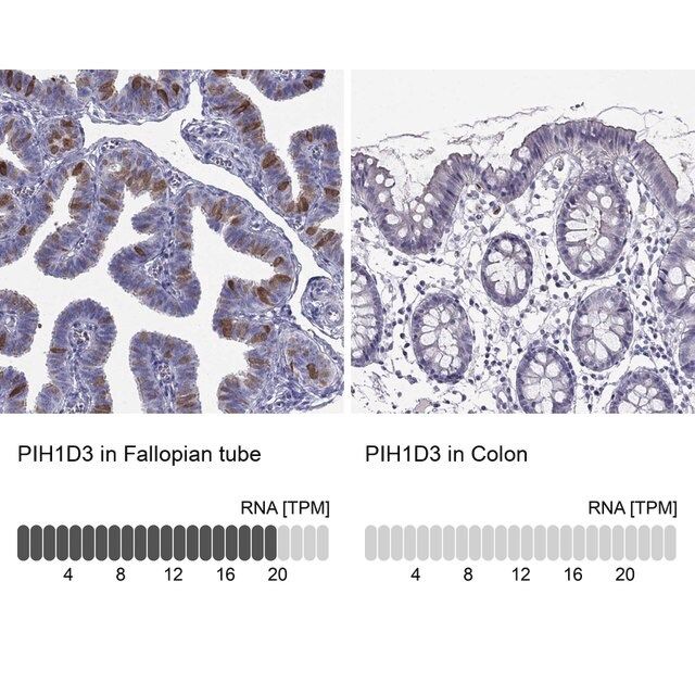 Anti-PIH1D3