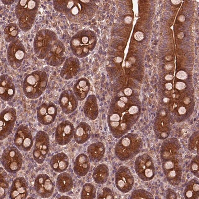 Anti-PIK3R2 antibody produced in rabbit