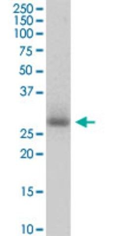 Anti-PIH1D1 antibody produced in mouse