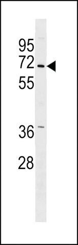 ANTI-PINK1 (PARK6) (CENTER) antibody produced in rabbit