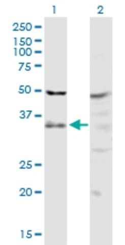 Anti-PIH1D1 antibody produced in rabbit