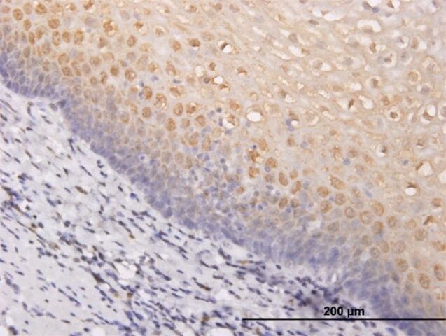 ANTI-PIM1 antibody produced in mouse