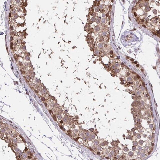 Anti-PIGY antibody produced in rabbit