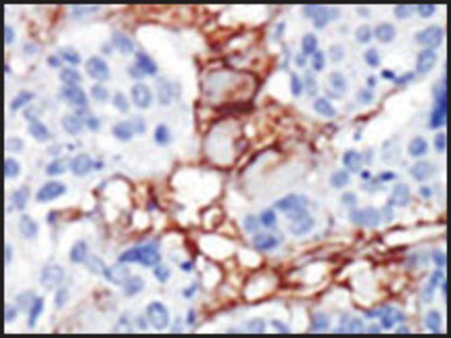 Anti-PIP5K2B (C-term) antibody produced in rabbit