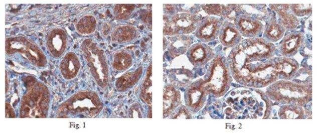 Anti-Pinch-1 Antibody, clone 9D2.1