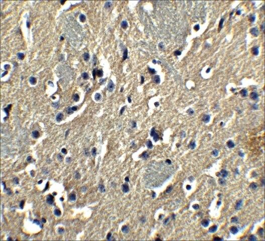 Anti-PION antibody produced in rabbit