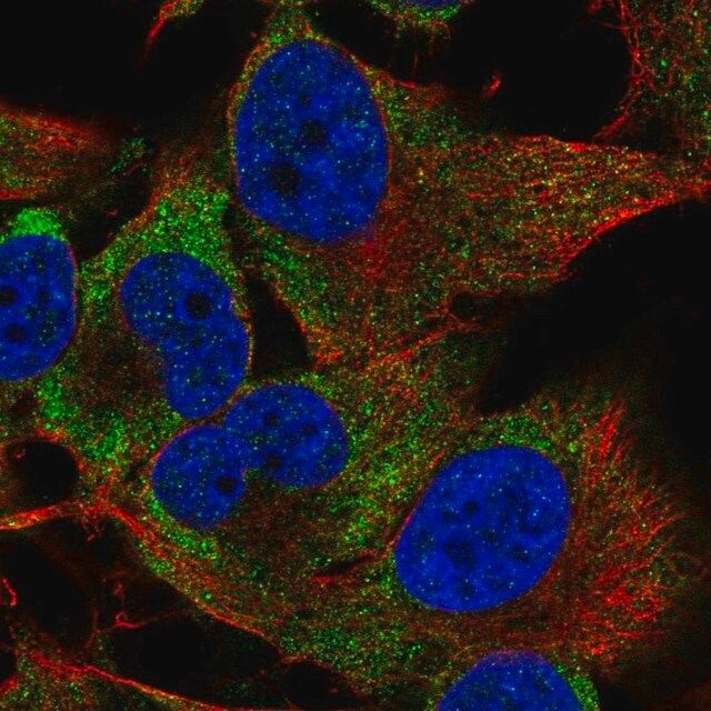 Anti-PIM3 antibody produced in rabbit