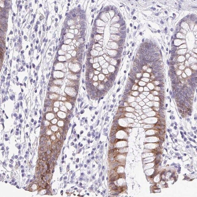 Anti-PIGK antibody produced in rabbit