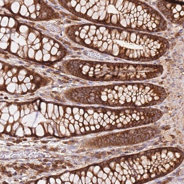 Anti-PIH1D1 antibody produced in rabbit