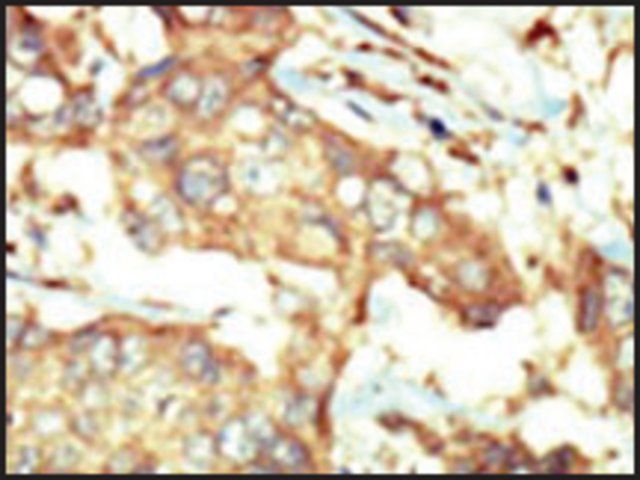 Anti-PI4KCA (N-term) antibody produced in rabbit