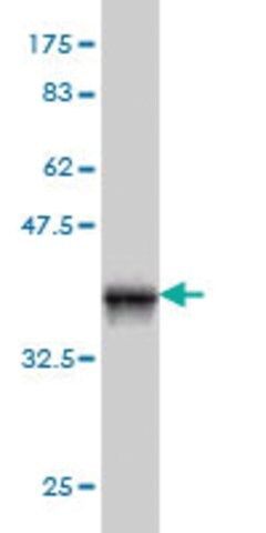 ANTI-PIM1 antibody produced in mouse