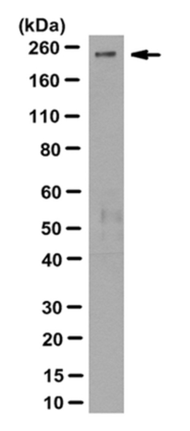 Anti-PIKFYVE Antibody, clone R159.4.3C9