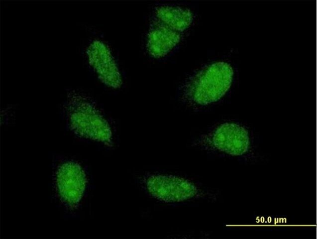 ANTI-PIM1 antibody produced in mouse