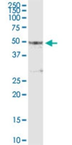 Anti-PIPOX antibody produced in rabbit