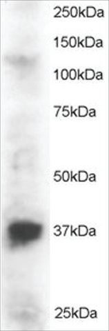 Anti-PINX1 antibody produced in goat