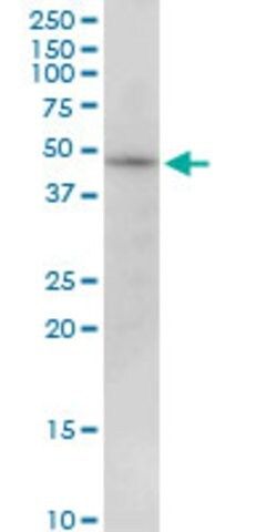 Anti-PIP4K2B antibody produced in mouse