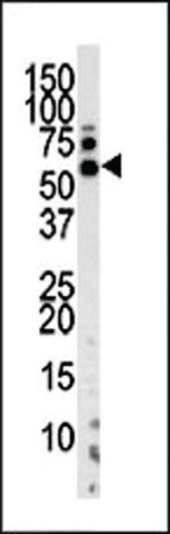 ANTI-PINK1 (PARK6) (N-TERM T133) antibody produced in rabbit