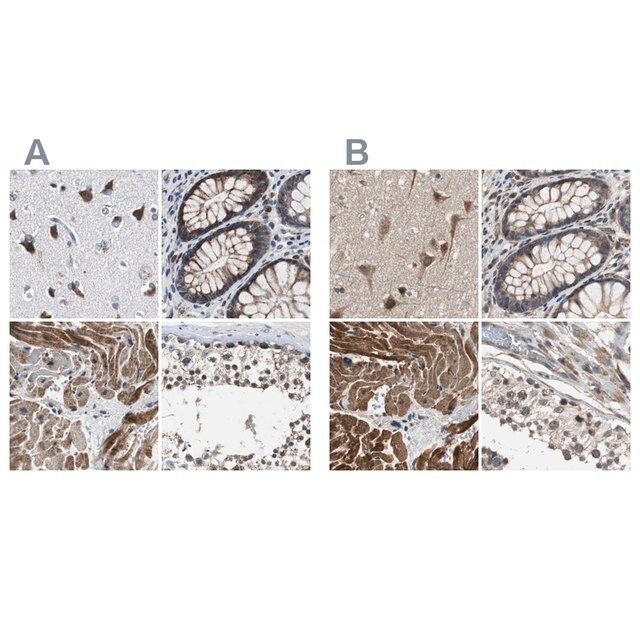 Anti-PITRM1 antibody produced in rabbit