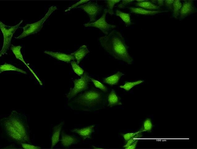 Anti-PIP5K1A antibody produced in rabbit