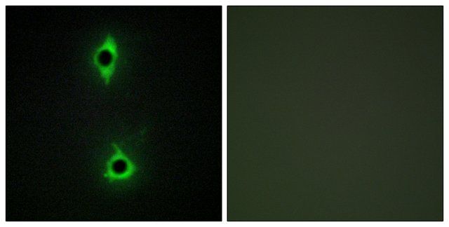 Anti-PIP5K antibody produced in rabbit