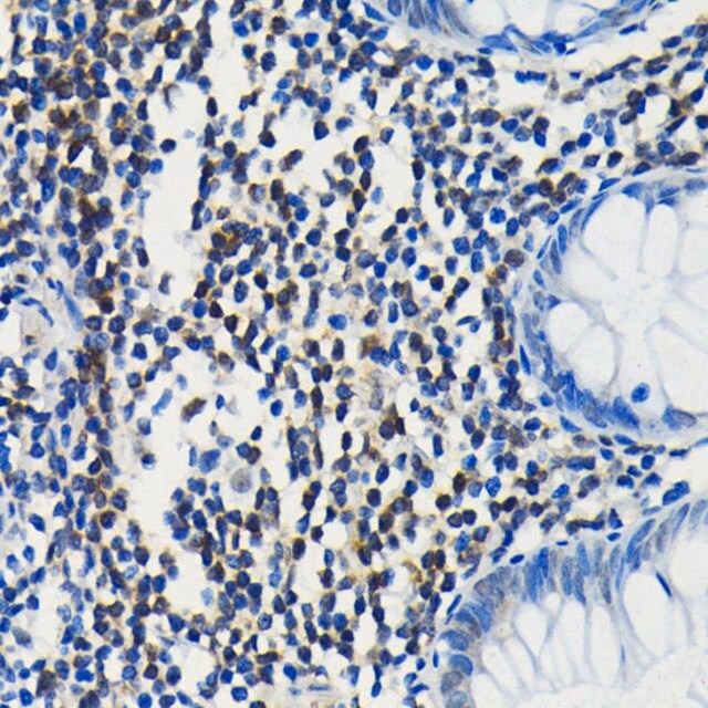 Anti-PIM1 antibody produced in rabbit